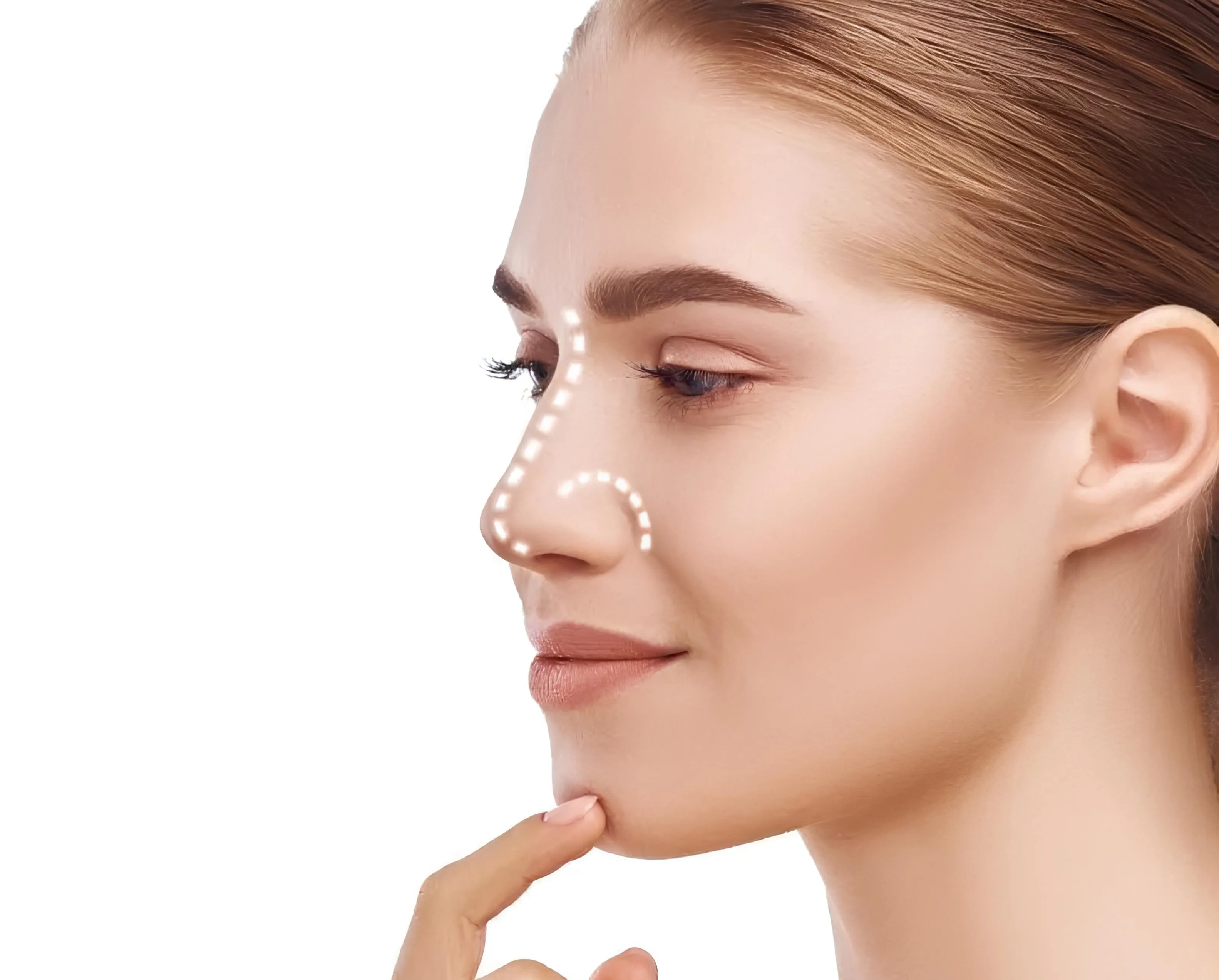 Rhinoplastie en Tunisie treatment visualization